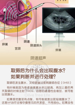 探究取卵过程中腹水产生的原因