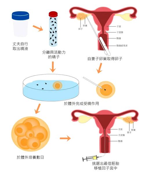探究FSH高对试管取卵数量的影响